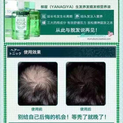 產(chǎn)后脫發(fā)怎么辦？這些方法幫你減少掉發(fā)，拒絕禿頂危機(jī)